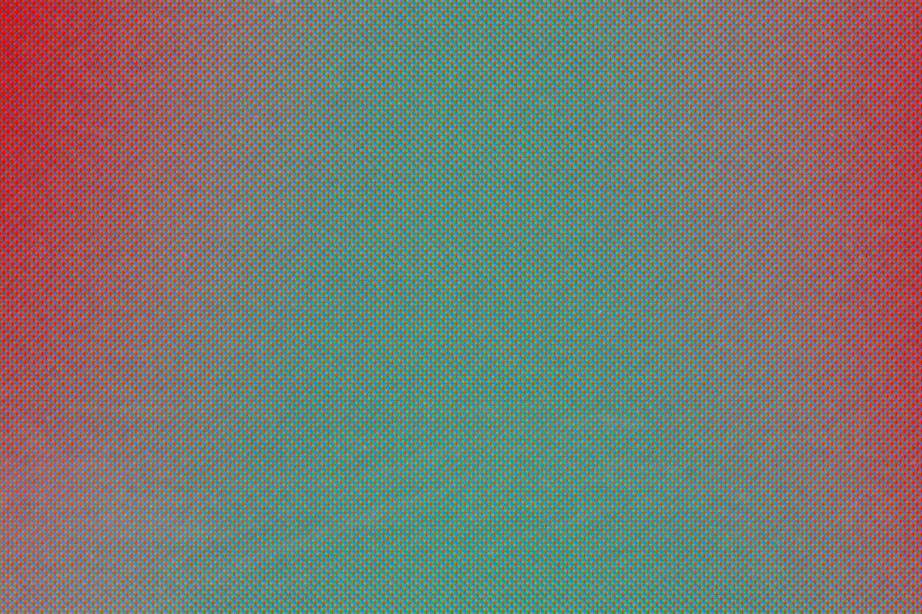 Person experiencing sensory overload and chronic overstimulation from modern life demands